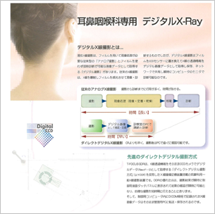 耳鼻科用Ｘ線撮影装置 CCD型デジタル画像記録装置付（T-FOCUS GDR）の特徴